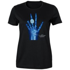 OKC Ring Torn Scapholunate Ligament Shirt 3 OKC Ring Torn Scapholunate Ligament Ladies Boyfriend Shirt